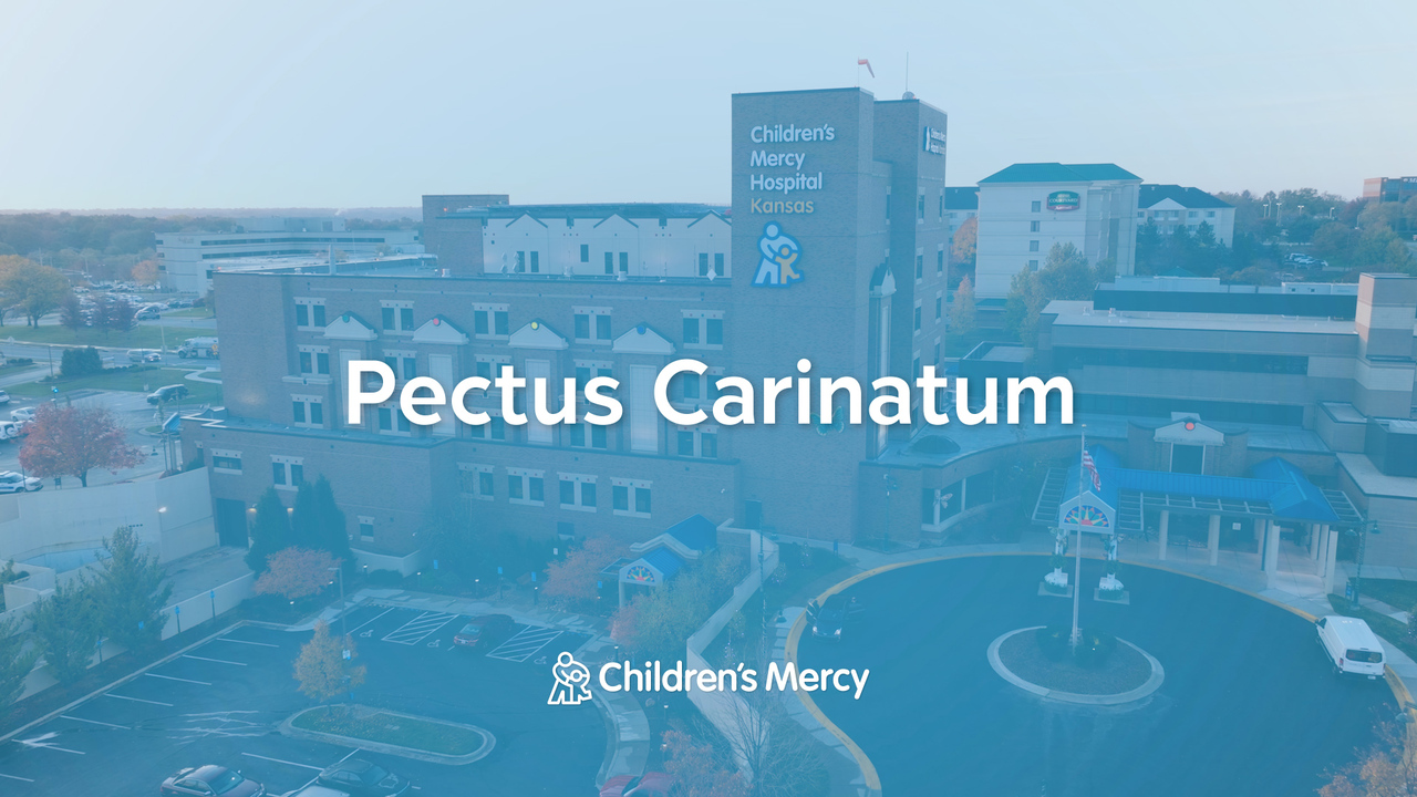 Pectus Carinatum