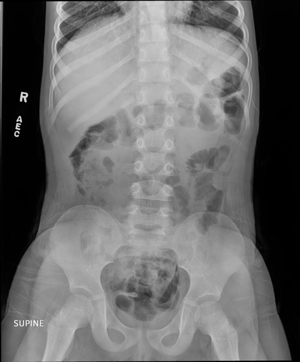 Radiograph