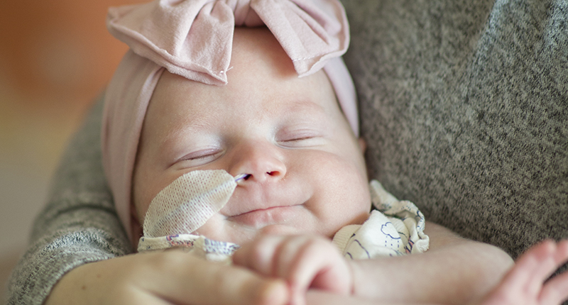 Close-up of an infant being held by a caregiver, wearing a pink bow headband and a nasal feeding tube, with eyes closed.