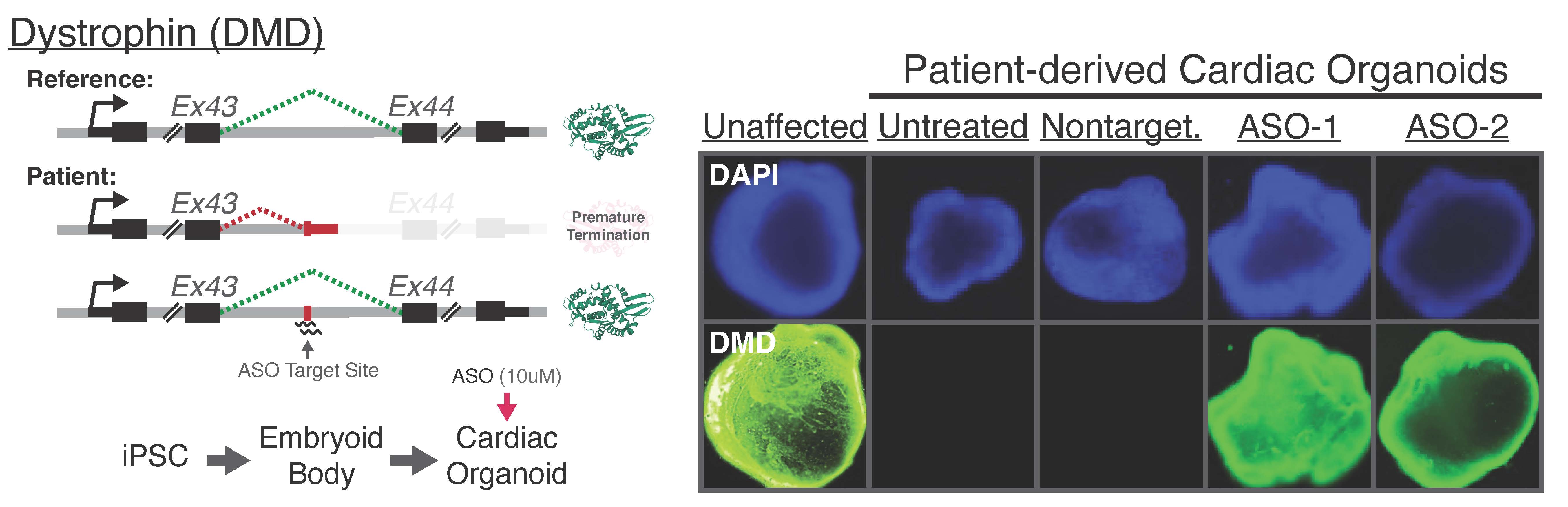 Schematic of patient-specific strategy for targeting DMD-causing mutation alongside patient-derived cardiac organoids treated with variant-targeting ASOs. Image on left says Dystrophin (DMD) at the top. Image at the right says Patient-Derived Cardiac Organoids at the top.