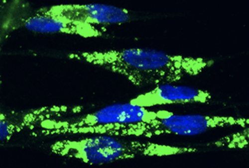 Accumulation of autophagosomes (green) within the patient-derived cells from a Vici syndrome child. The image is on a black background and it is lit up in green and blue.