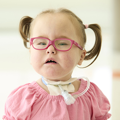 Child wearing pink glasses and a tracheostomy tube, photographed against a light background