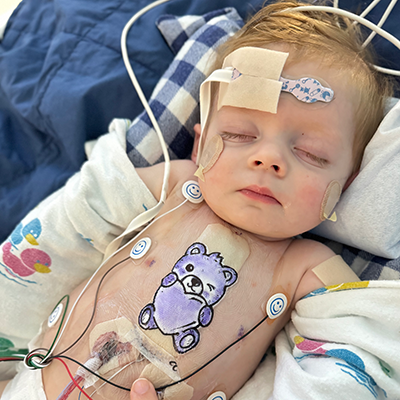 Young child resting with eyes closed while connected to medical monitoring leads and tubing, with a cartoon bear drawn on the chest.
