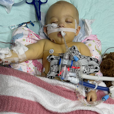 A baby sleeps in a hospital bed. She has tubes and wires attached to her nose, arms and body. She's partially covered with a pink and white striped blanket and on top a pillow with a cheerful cartoon animal print. There’s a stuffed animal on her left side. 