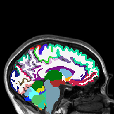 A scan of a brain. The background is black and the brain scan shows lots of different colors.