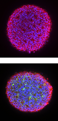Above: A cardiac organoid created from cellular lines derived from a patient with Duchenne muscular dystrophy (DMD). Below: A cardiac organoid generated from the same DMD patient. Both are circular, iridescent, and lit up in colors of fuchsia, and purple. 
