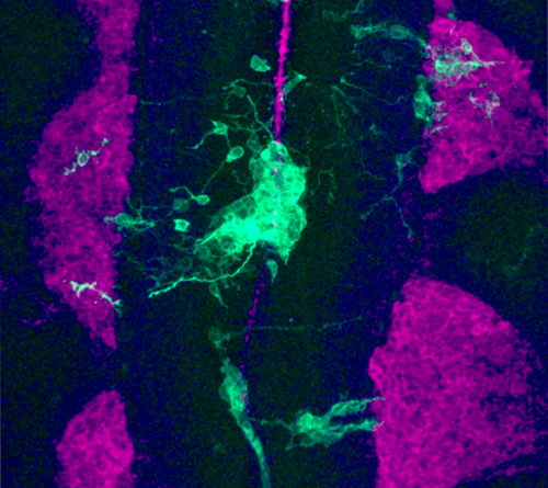 An image of the colors fuchsia  and light green lit up in iridescent colors. The image is of human neuroblastoma cells, taken through a microscope.