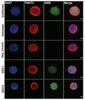 An image of 4 columns and 5 rows. The top of the columns are titled DAPI, TNNT2, DMD, and Merge. Each row in the column on the left has a circular molecule image in blue, the next column they are all red, then green, then various colors.