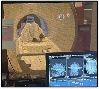 Patient undergoing brain fMRI scan by laying down and being moved into the machine.