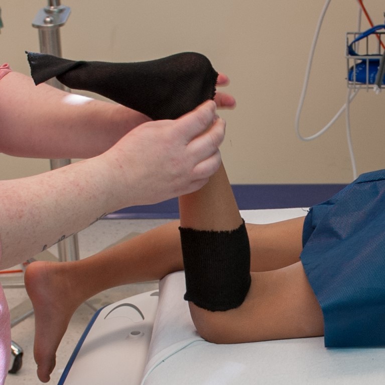 image of step 1 of getting a cast, applying a sock