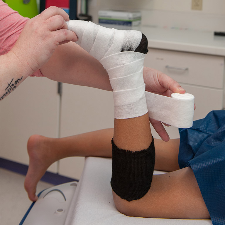 image of step 2 of getting a cast, applying material around the sock