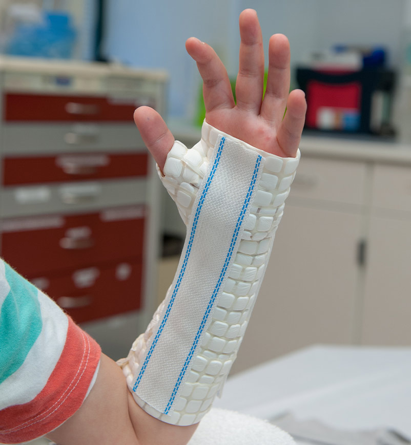 step 1 of a waterproof cast, a soft waterproof wrap is applied