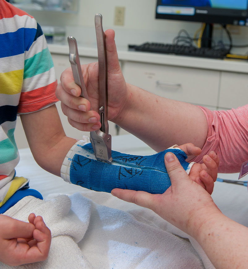 image of a step in removing a cast, using a tool to open the cast