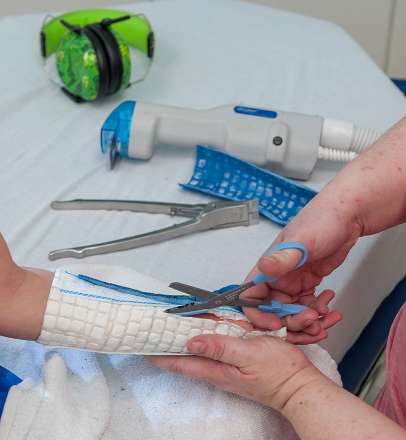 image of another step in the cast being removed, using scissors to remove the inner wrapping