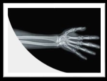 image of an xray of a hand