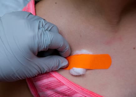 nurse with gloves placing orange band-aid over port site. 